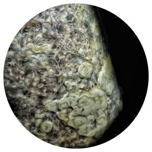 Philosopher's Stones